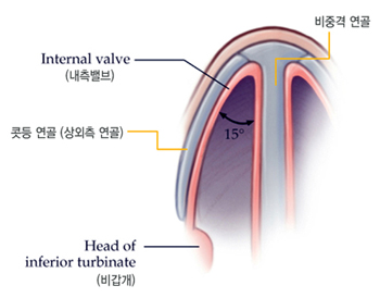 비중격연골과 내측 밸브의 각도를 설명하는 그림