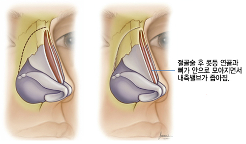       鼭  갡  ¸ ϴ ׸