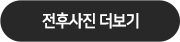 전후사진