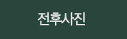 전후사진