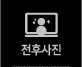 전후사진